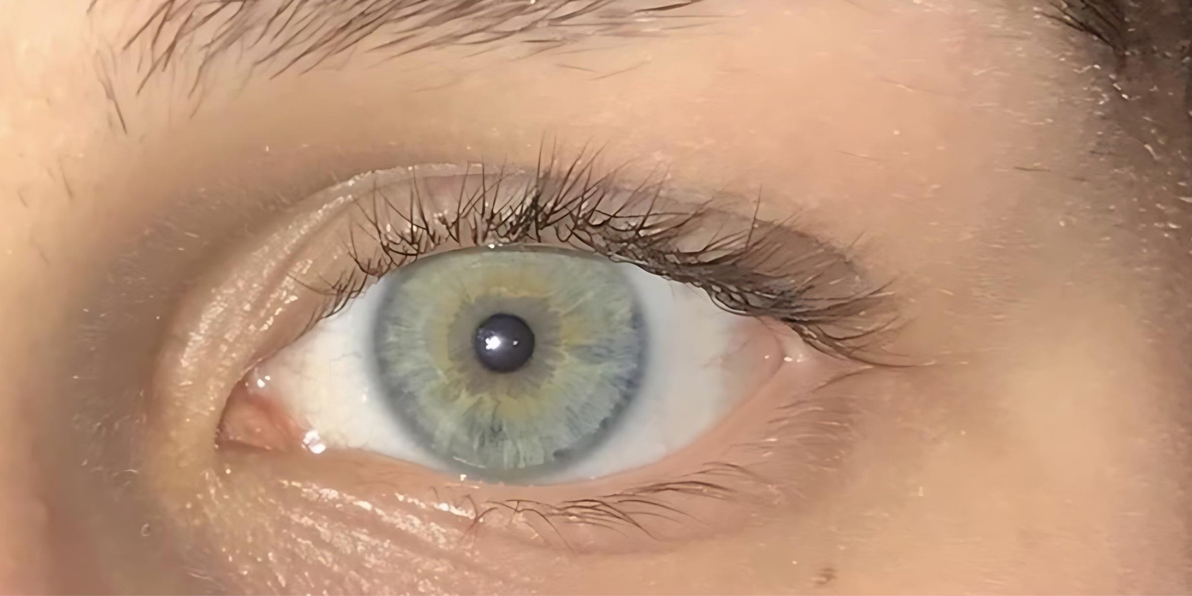 A close-up photo of a woman's eye before using The Eye Balm™.